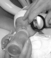 image of a newborn receiving an ophthalmology exam