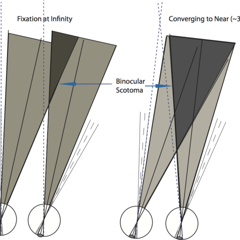 diagram of eyes tracking target and scotoma result