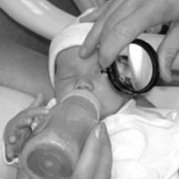 infant receiving an eye exam