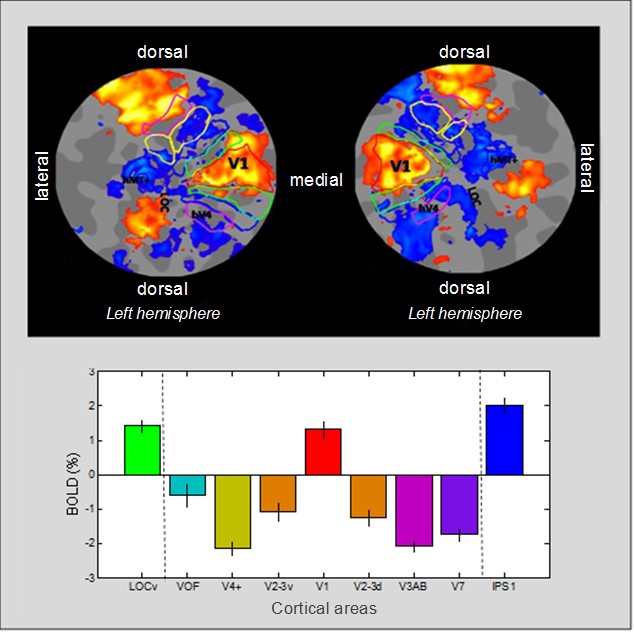 Brain activation & suppression during blindfolded memory-guided drawing; the primary visual cortex (V1) is isolated by profound extrastriate suppression.