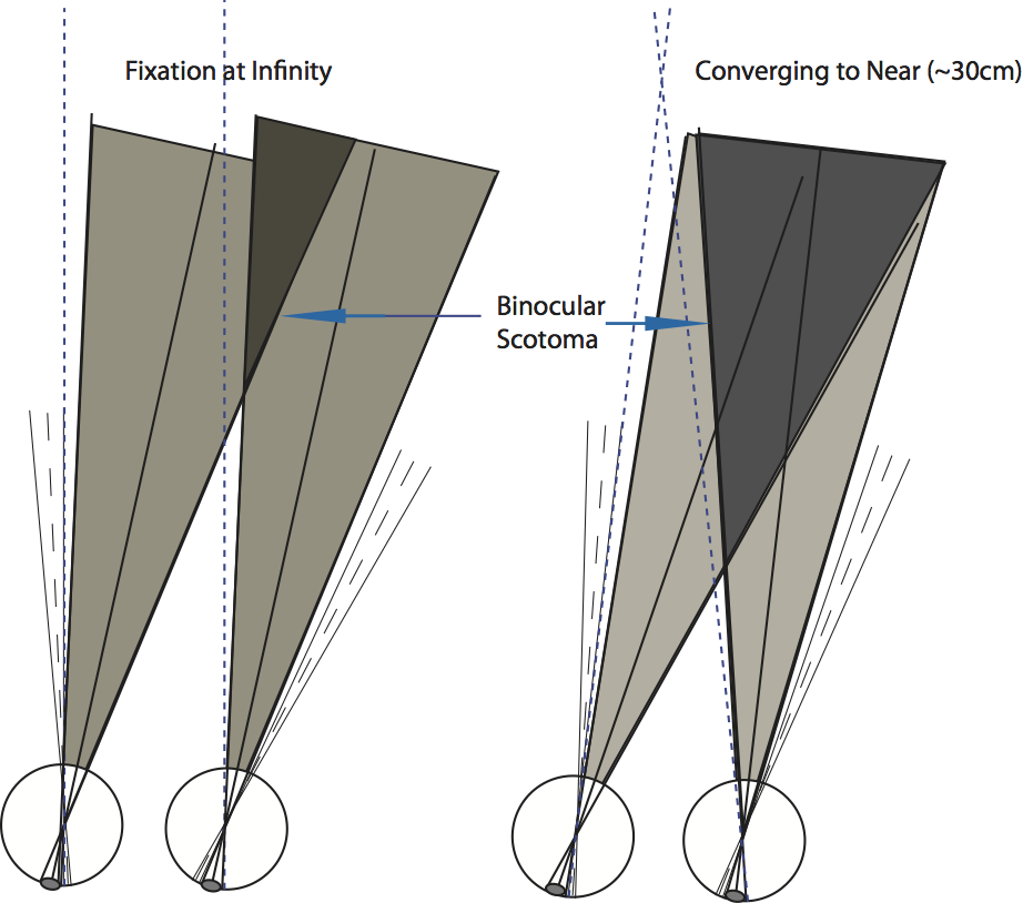 diagram of eyes tracking target and scotoma result